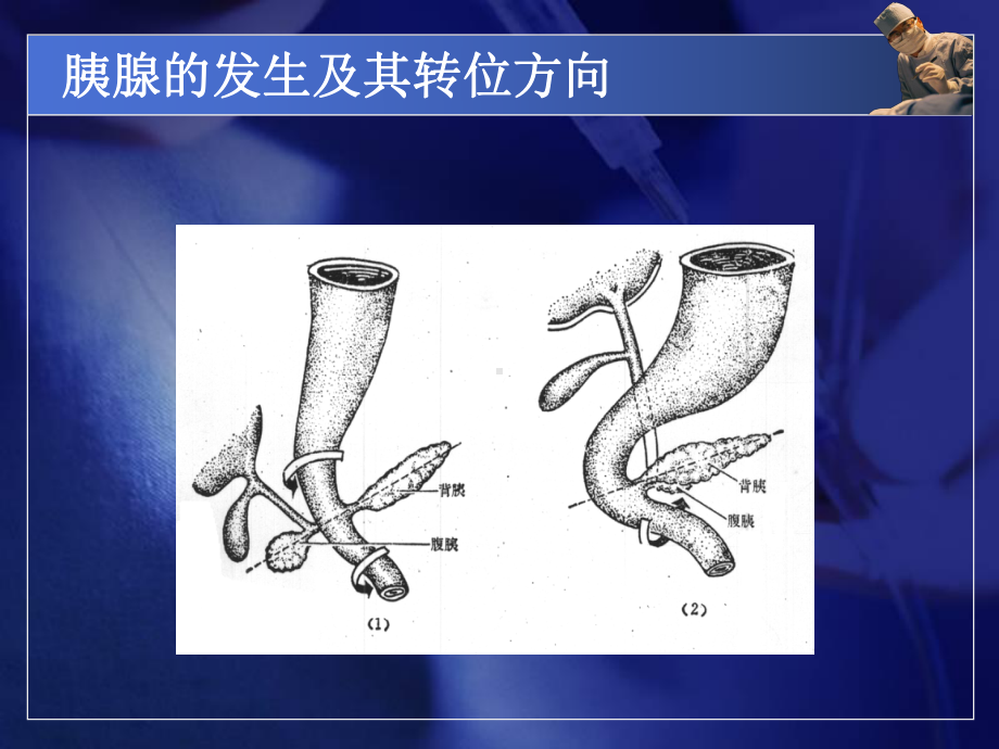 急性胰腺炎小讲指导课件.pptx_第3页