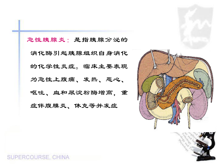 急性胰腺炎病人的护理-5课件.pptx_第3页