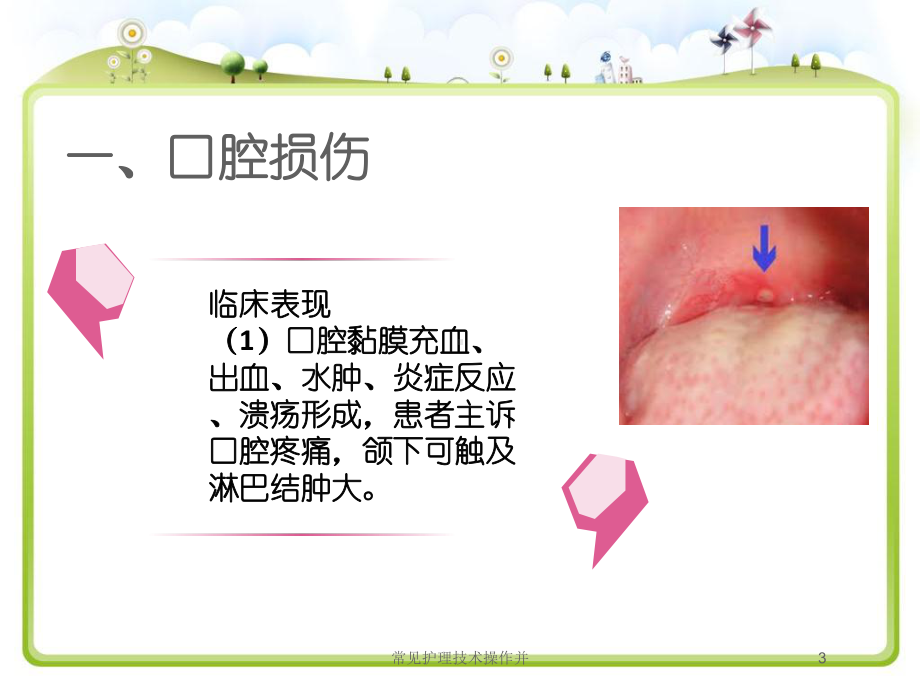 常见护理技术操作并培训课件.ppt_第3页