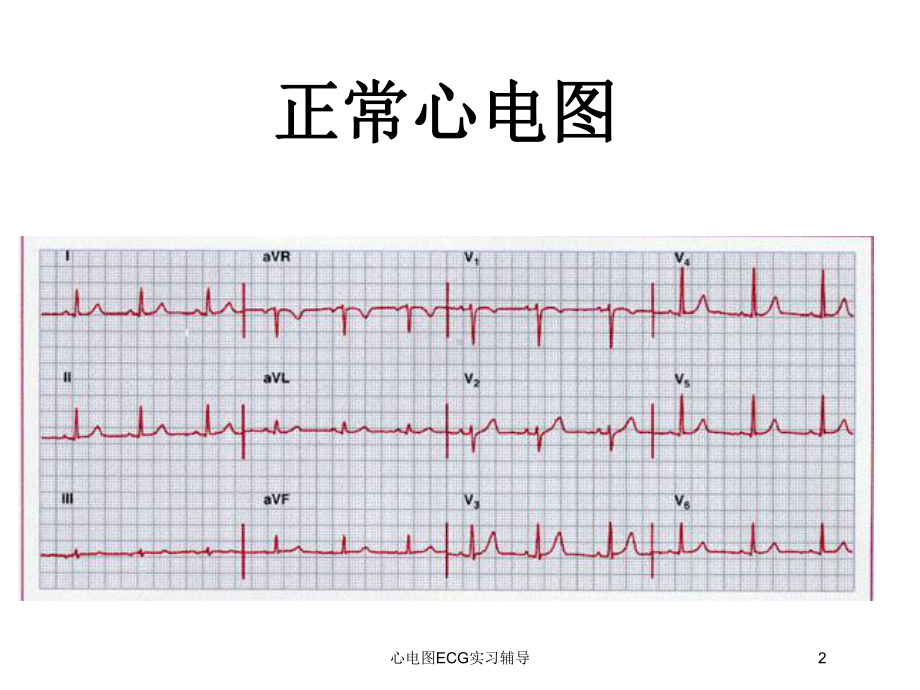 心电图ECG实习辅导培训课件.ppt_第2页