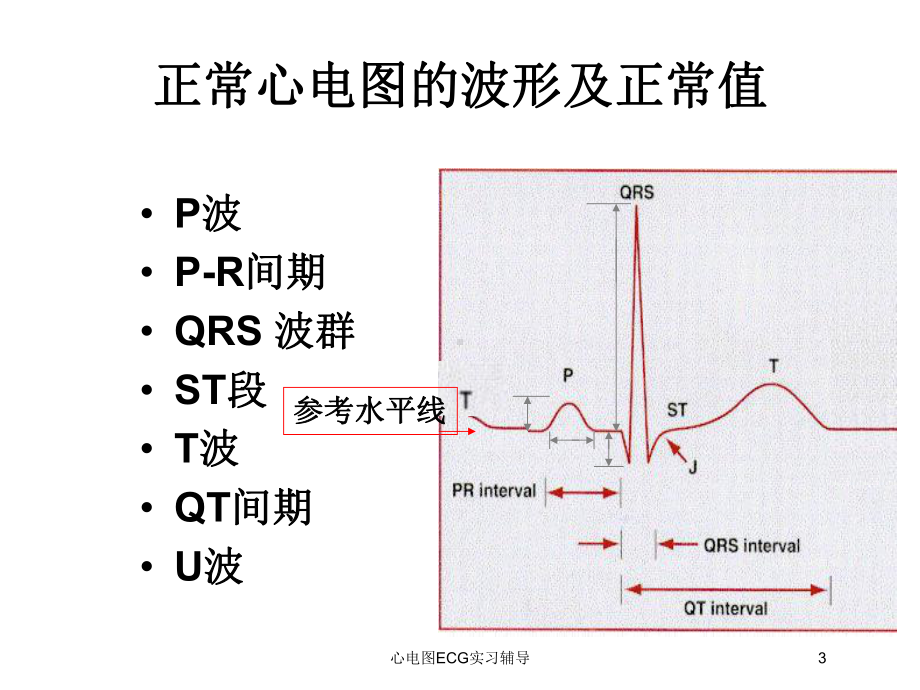 心电图ECG实习辅导培训课件.ppt_第3页