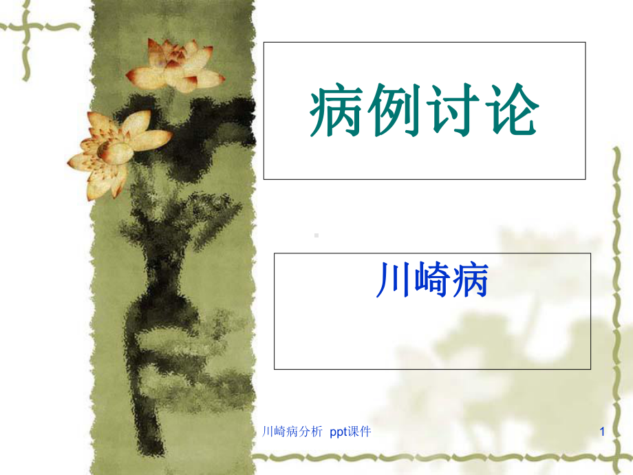 川崎病分析-课件.ppt_第1页