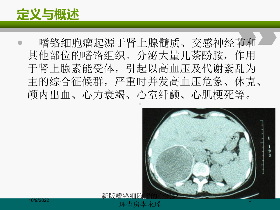 新版嗜铬细胞瘤的个案护理查房培训课件.ppt_第3页