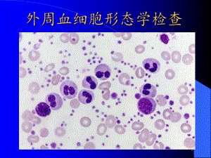 检验科-外周血涂片检查教学课件.ppt