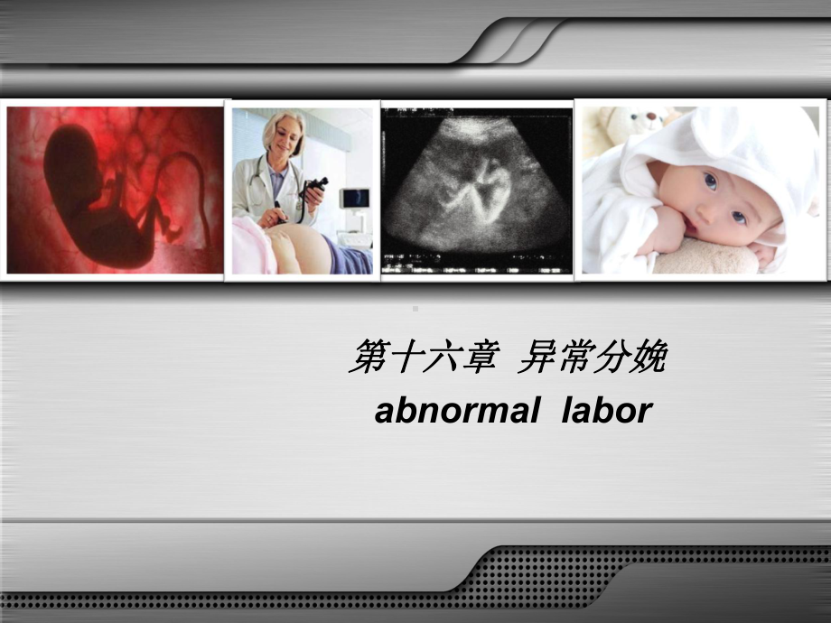 异常分娩胎位异常课件.ppt_第3页