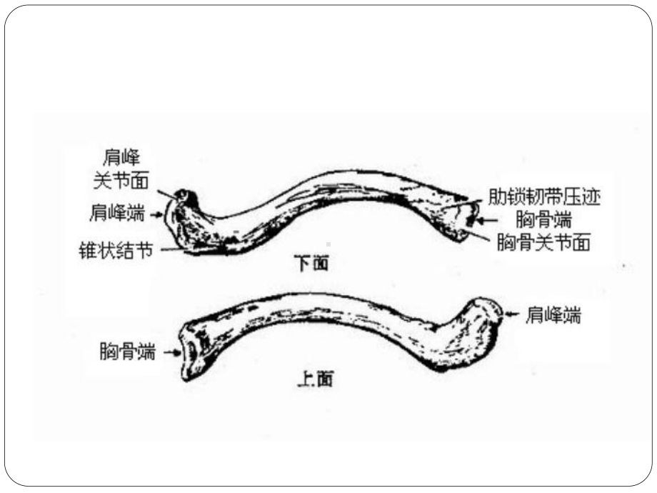 有关锁骨骨折课件.ppt_第3页