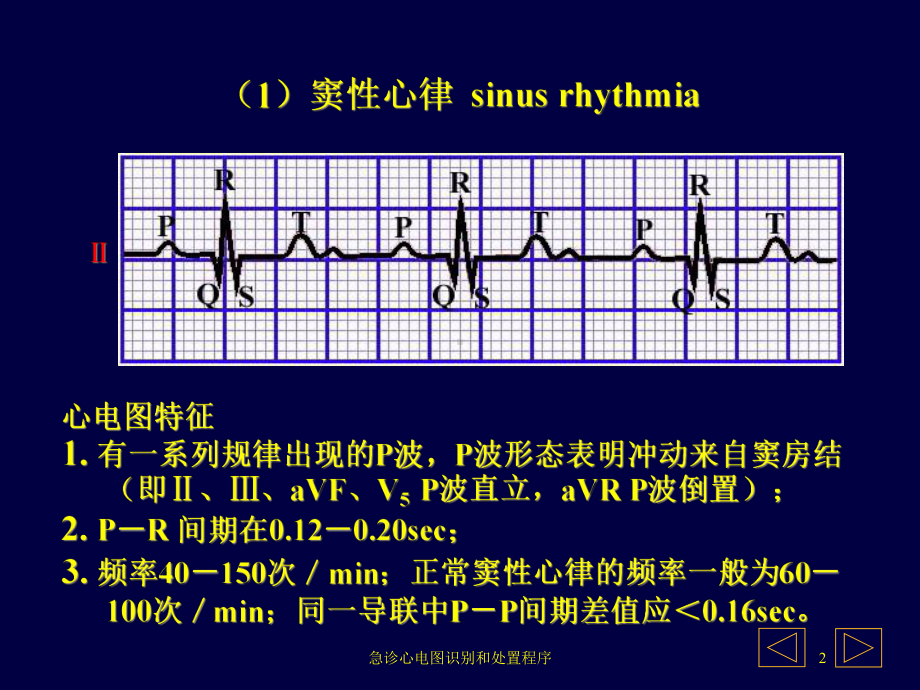 急诊心电图识别和处置程序培训课件.ppt_第2页