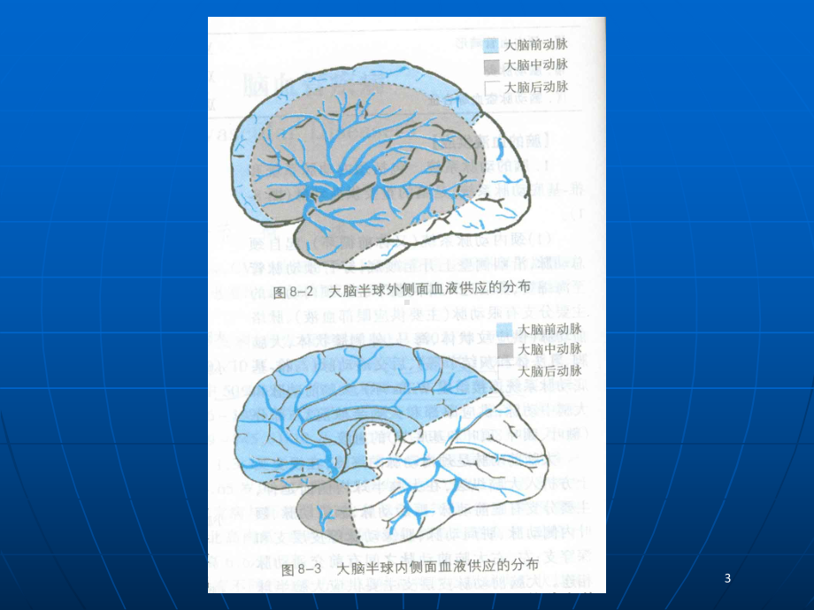 急性脑血管疾病医疗管理知识分析培训课件.ppt_第3页