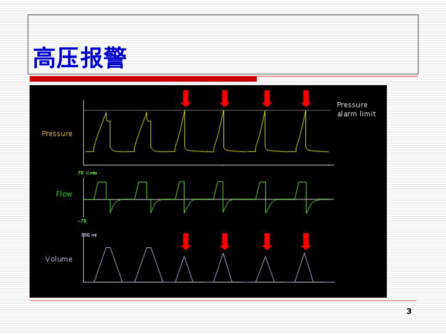 有创通气常见临床问题的处理教学课件.ppt_第3页