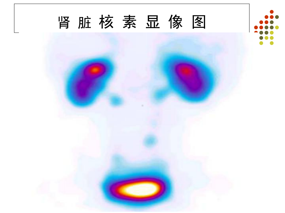 核医学第11章肾显像及功能测定课件.ppt_第3页