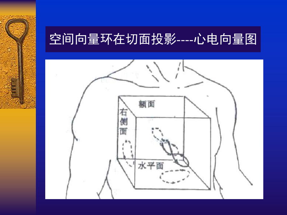 常见心电图诊断要点课件.pptx_第2页