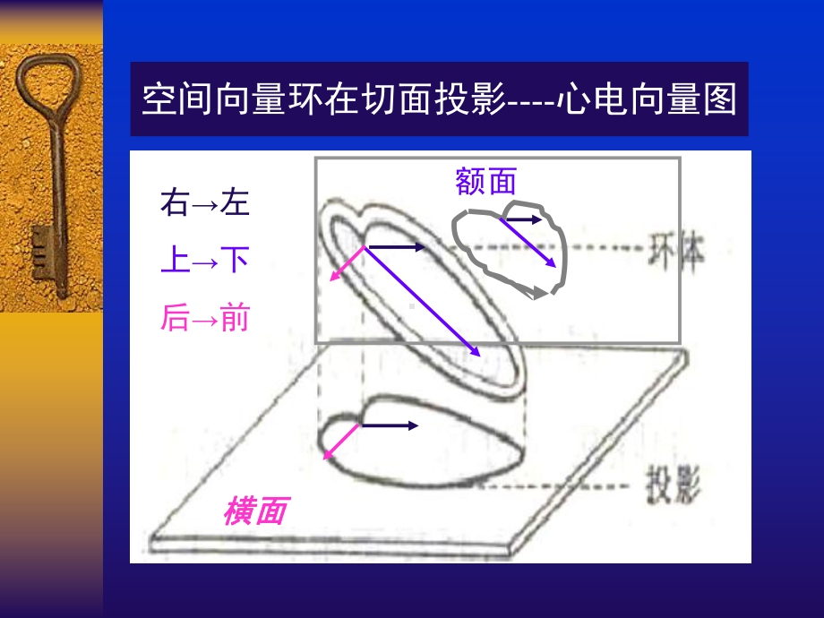 常见心电图诊断要点课件.pptx_第3页