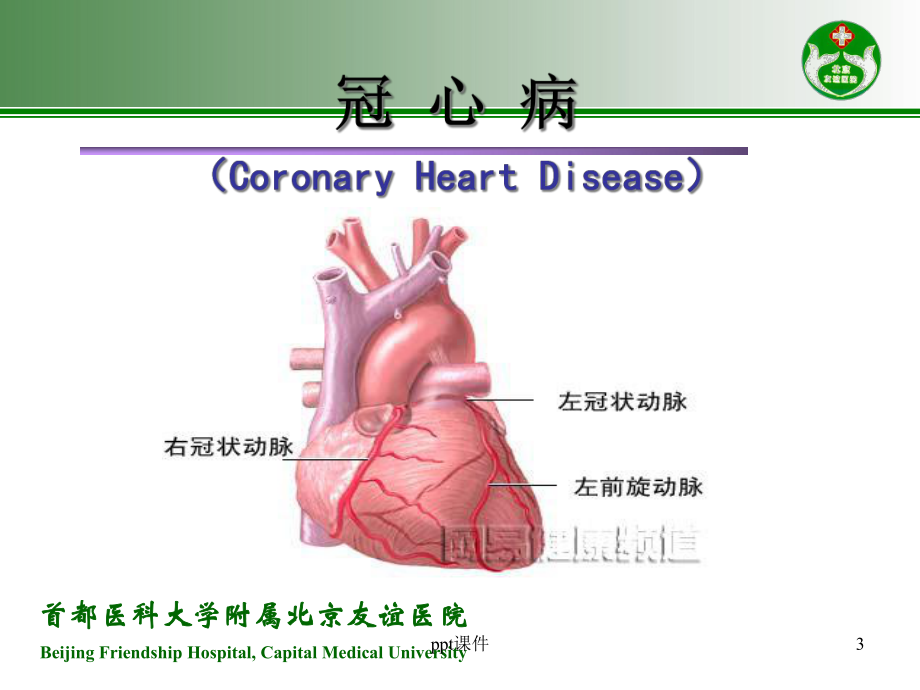 心绞痛与急性心肌梗死的识别-课件.ppt_第3页