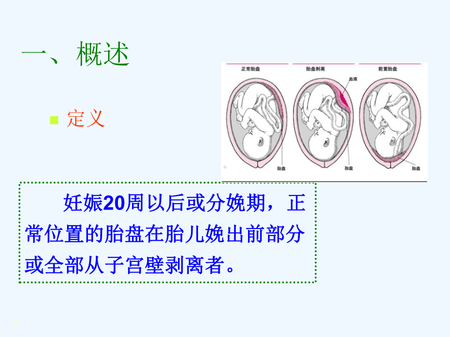 异常产褥妇产科学课件.ppt_第2页