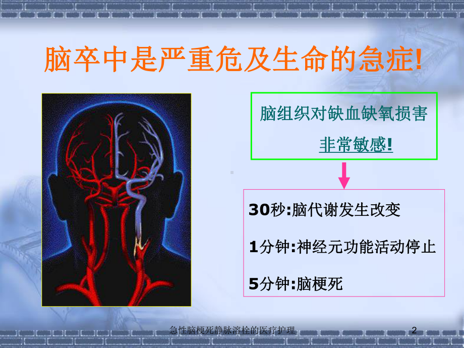 急性脑梗死静脉溶栓的医疗护理培训课件.ppt_第2页