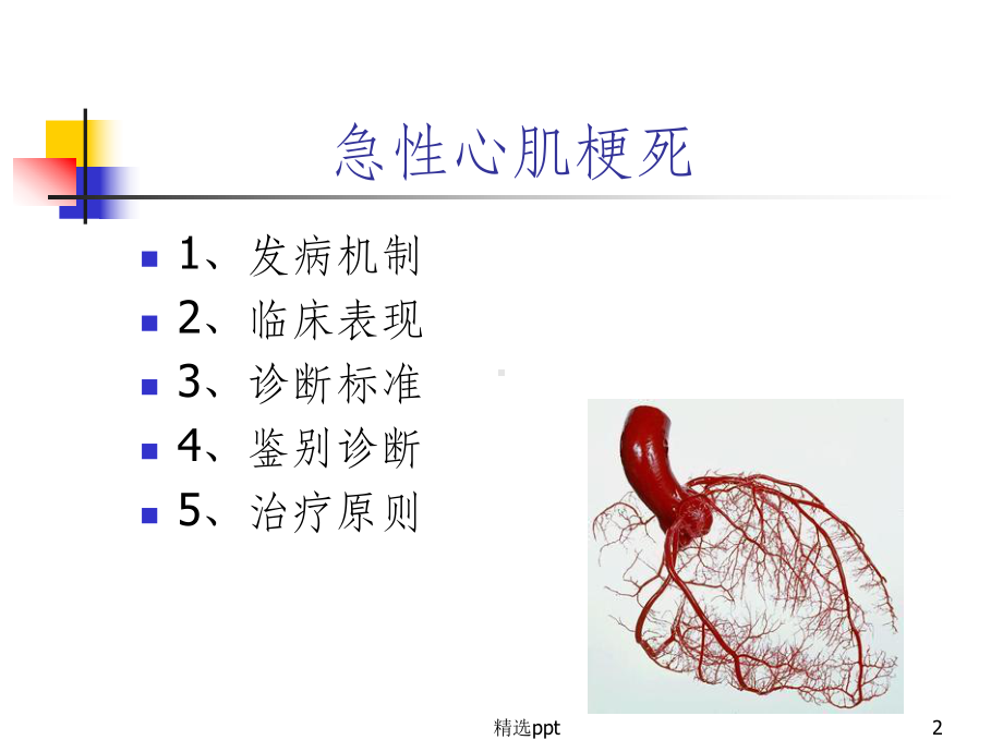 急性心肌梗死课件22373课件.ppt_第2页