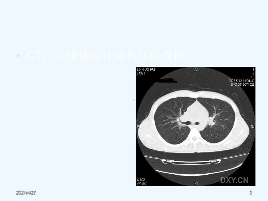 影像学检查在临床医学中的应用课件.ppt_第2页