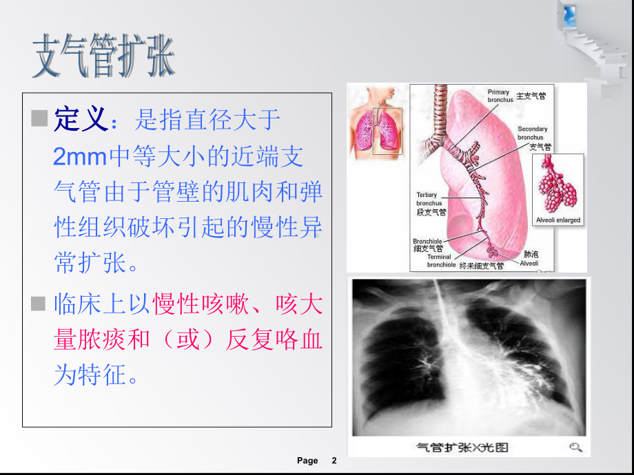 支气管扩张伴咯血-教材课件.ppt_第2页