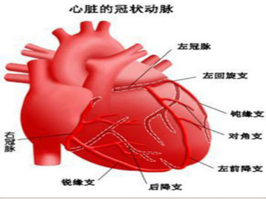 急性前壁心肌梗死护理查房李霞课件.ppt_第3页