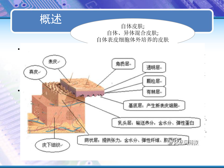 植皮病人的围手术期护理及VSD负压吸引技术-课件.pptx_第3页