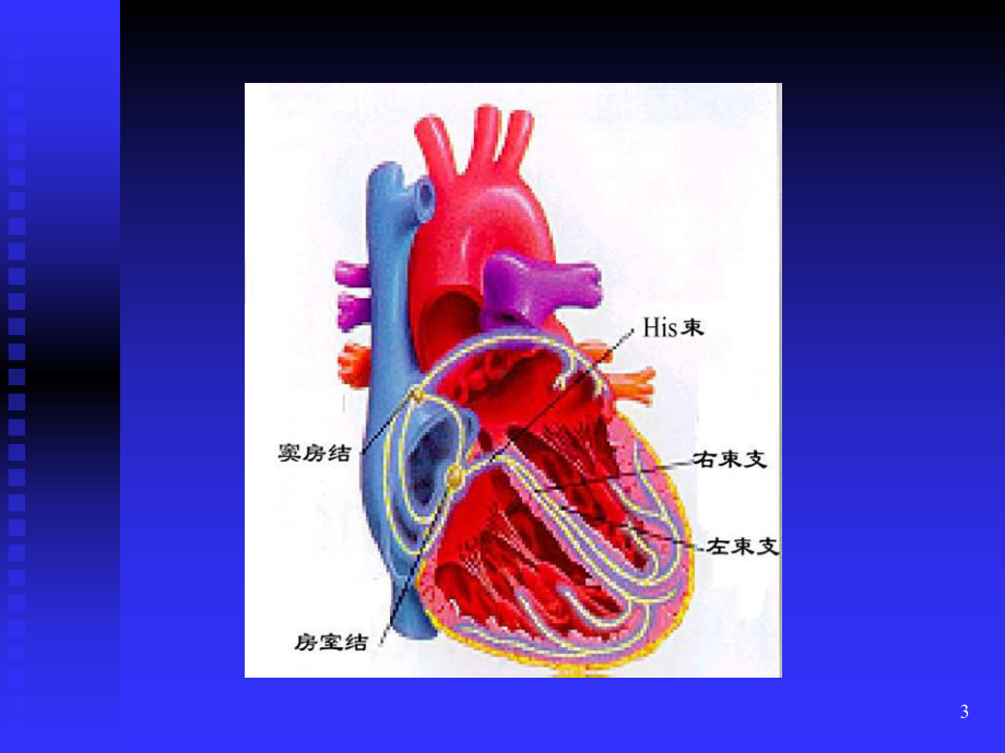 心律失常心电图的判读演示文稿课件.ppt_第3页