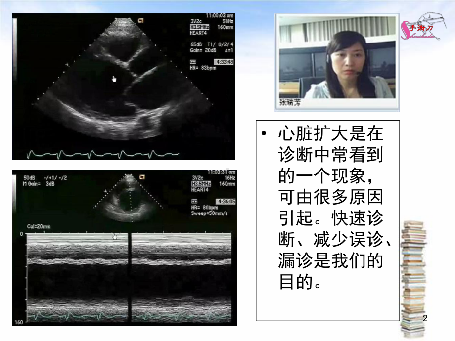 心脏扩大的超声诊断思路医学课件.ppt_第2页