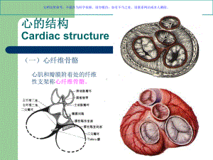 心脏粘液瘤专题宣讲课件.ppt