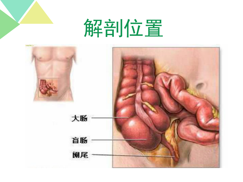 急性阑尾炎术后的医疗护理讲义课件.ppt_第3页