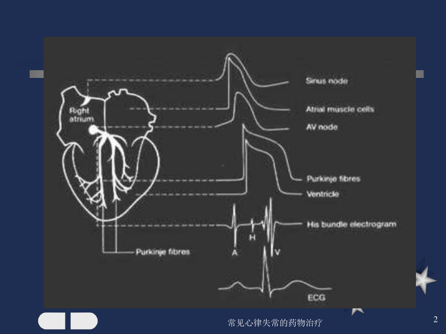 常见心律失常的药物治疗课件.ppt_第2页