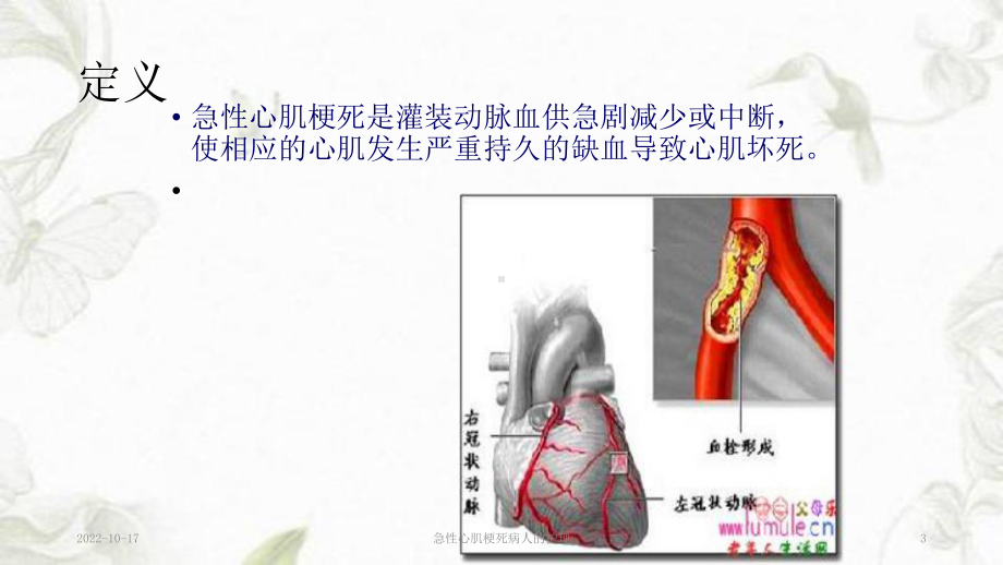 急性心肌梗死病人的护理课件.ppt_第3页