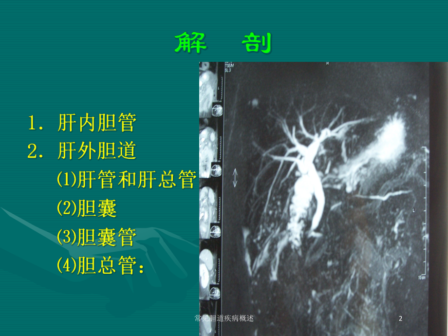 常见胆道疾病概述培训课件.ppt_第2页