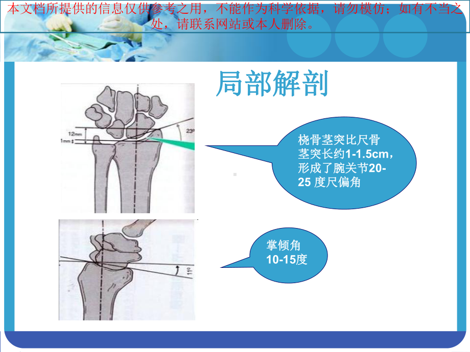 手法复位小夹板固定治疗Colles骨折培训课件.ppt_第2页