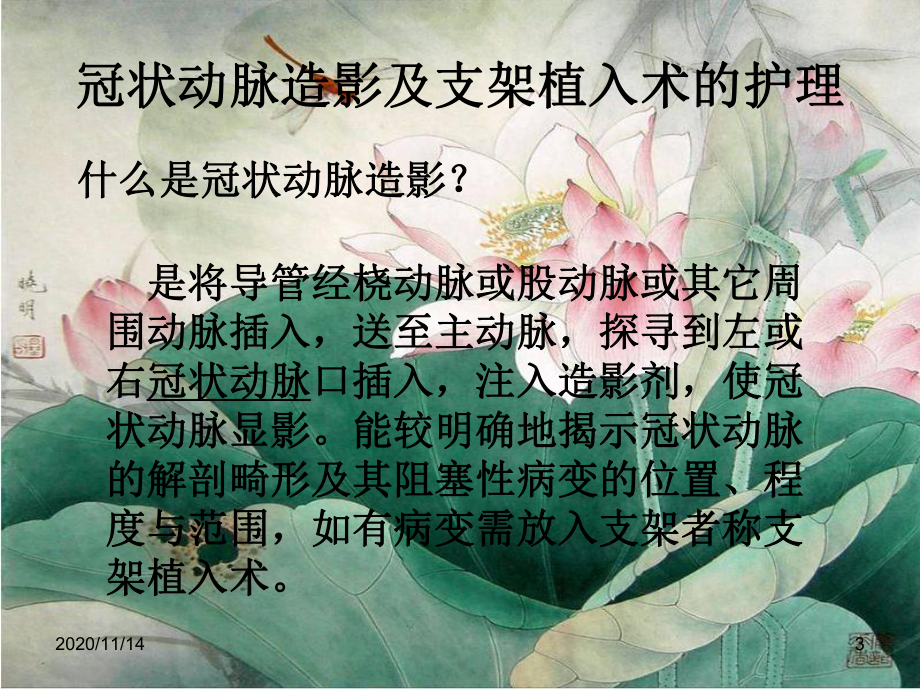 心内科常见手术护理课件.ppt_第3页