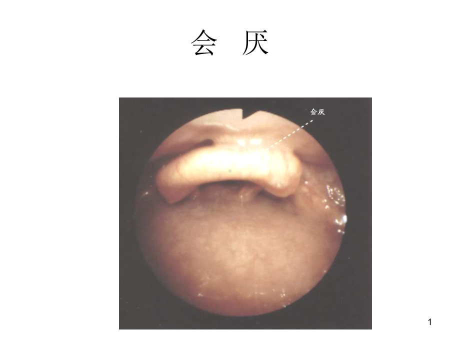 支气管镜精美图谱课件.pptx_第1页