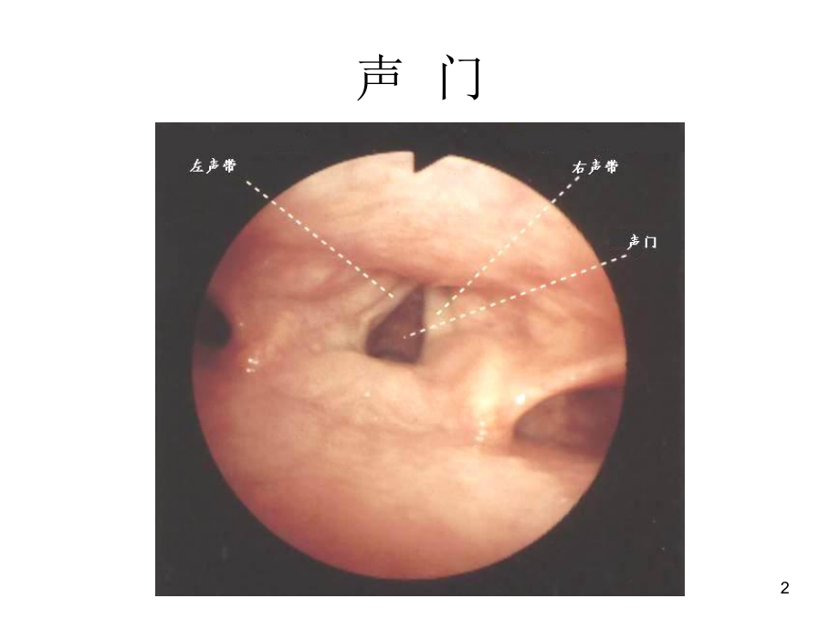 支气管镜精美图谱课件.pptx_第2页