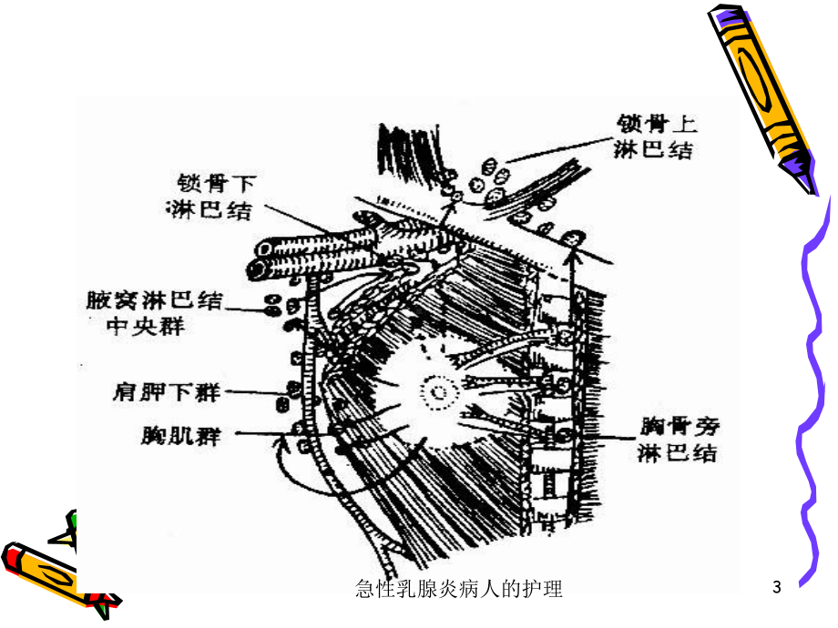 急性乳腺炎病人的护理培训课件.ppt_第3页