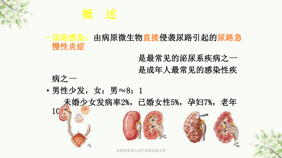 尿路感染病人的护理描述最全面课件.ppt_第3页