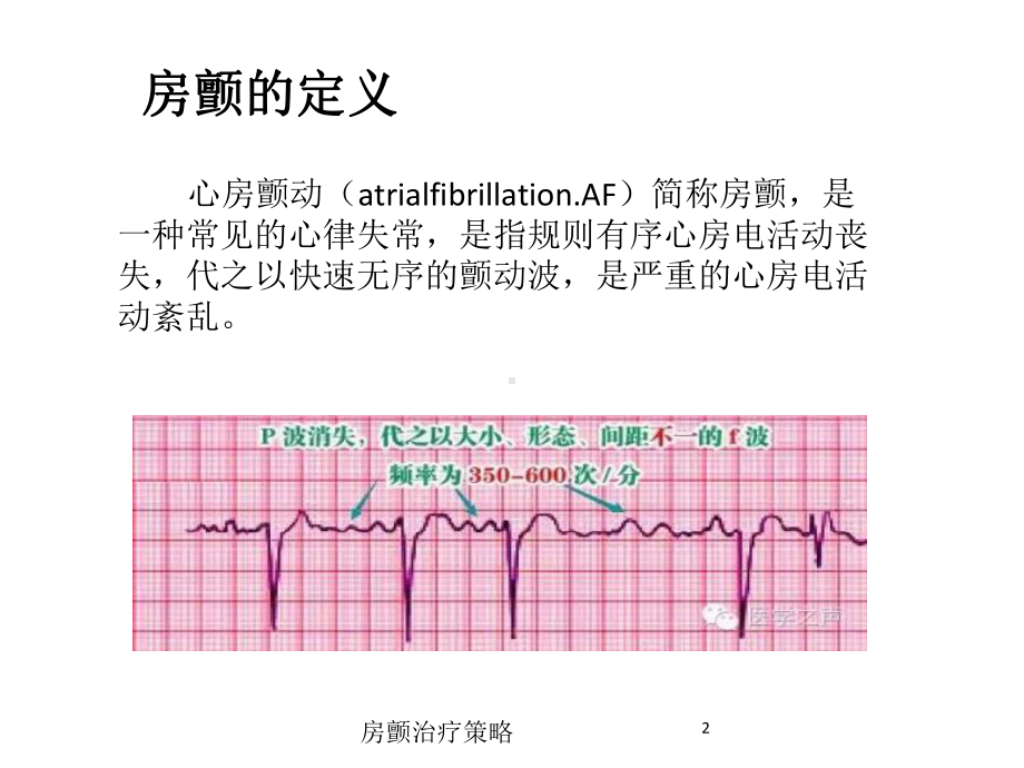 房颤治疗策略培训课件.ppt_第2页