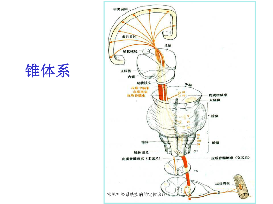 常见神经系统疾病的定位诊疗培训课件.ppt_第3页