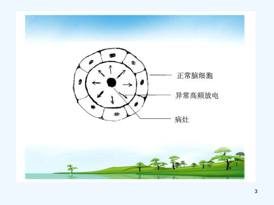 抗癫痫及抗惊厥药物医学课件.ppt_第3页