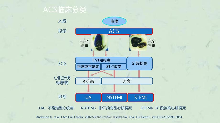 急性冠脉综合征诊断标准及治疗课件.ppt_第3页