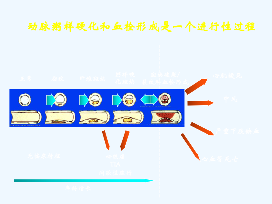 急性冠脉综合征患者主要治疗手段课件.ppt_第2页