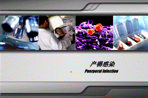 有关产褥感染课件.pptx