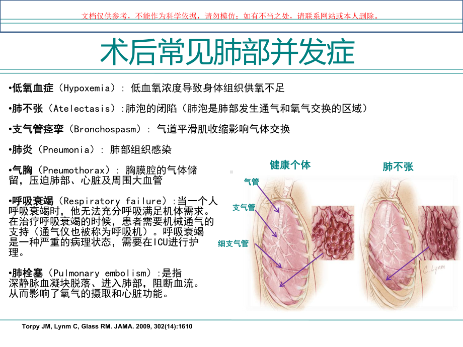 术后肺部并发症高危患者围手术期管理培训课件.ppt_第2页