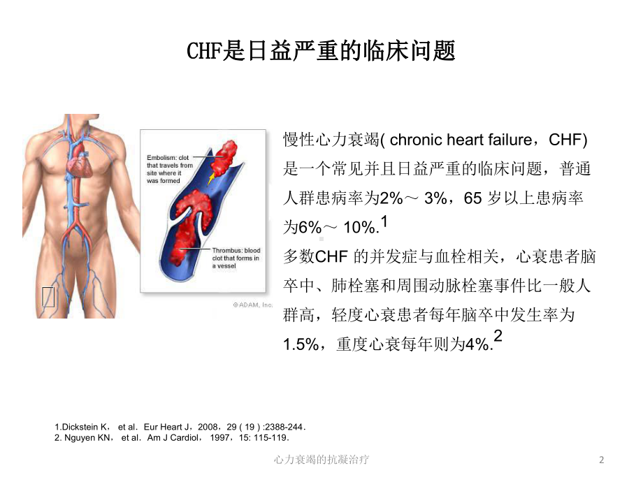 心力衰竭的抗凝治疗培训课件.ppt_第2页