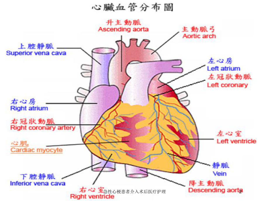 急性心梗患者介入术后医疗护理培训课件.ppt_第2页