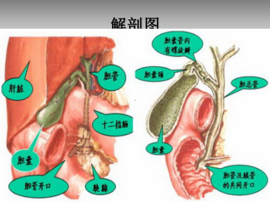 急性梗阻性化脓性胆管炎的医疗护理讲义课件.ppt_第3页