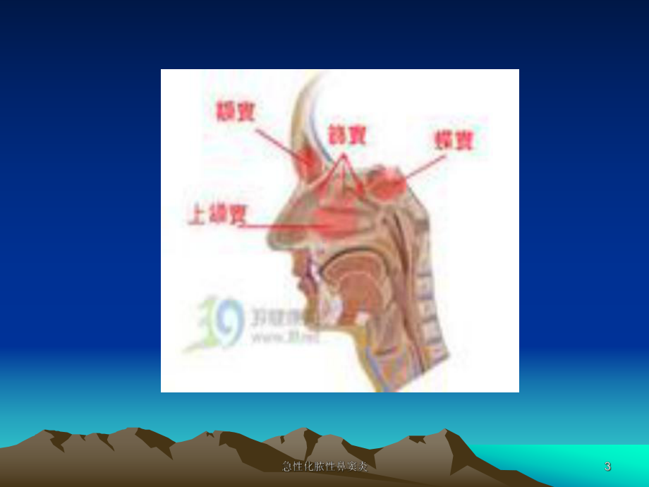 急性化脓性鼻窦炎培训课件.ppt_第3页