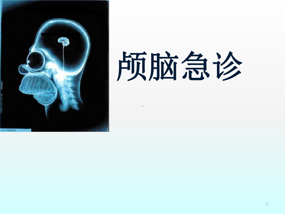 急诊CT诊断课件.ppt_第3页