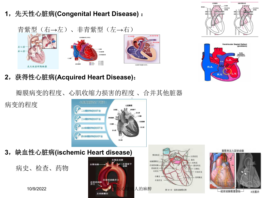 新版心脏病人的麻醉培训课件.ppt_第1页